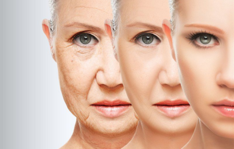 5 dấu hiệu cho thấy phẫu thuật căng da mặt có thể phù hợp với bạn