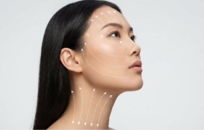 Căng da mặt bằng chỉ Collagen có biến chứng không - Thẩm mỹ Á Đông Căng da mặt bằng chỉ Collagen có biến chứng không - Thẩm mỹ Á Đông