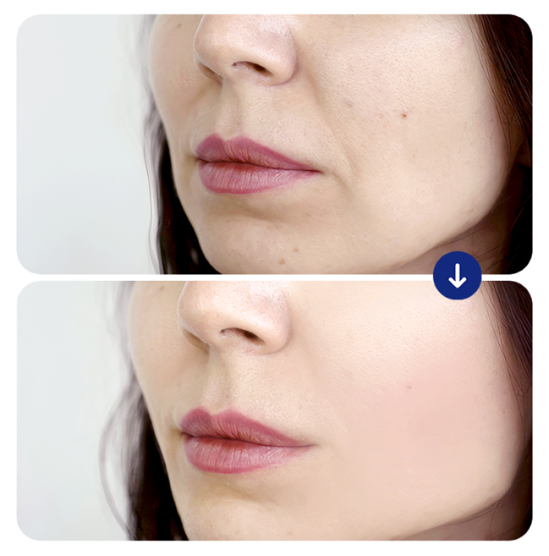 tre-hoa-da-tieu-phau-14 tre-hoa-da-tieu-phau-14