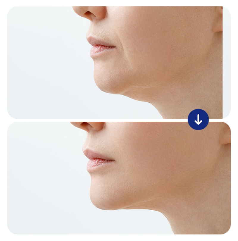 tre-hoa-da-tieu-phau-15 tre-hoa-da-tieu-phau-15