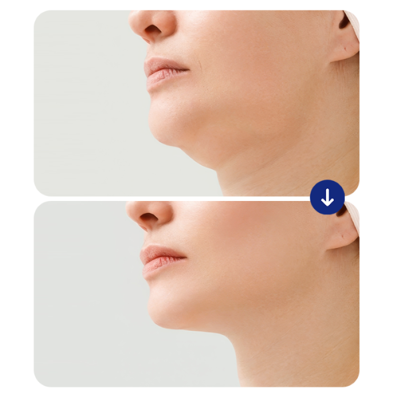 tre-hoa-da-tieu-phau-16 tre-hoa-da-tieu-phau-16